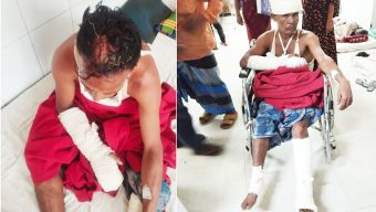 গোয়াইনঘাটে গাছ কাঠা নিয়ে বিরোধ: প্রতিপক্ষের হামলায় মহিলাসহ আহত-২