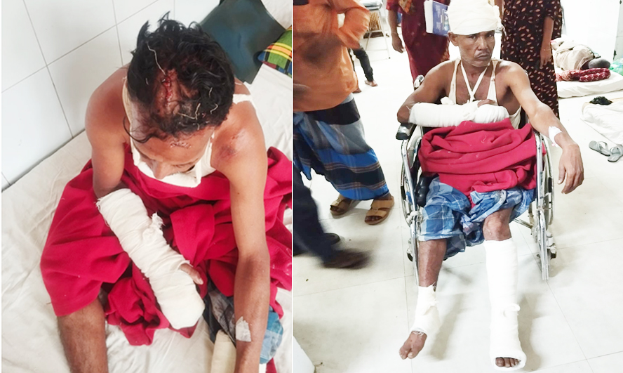 গোয়াইনঘাটে গাছ কাঠা নিয়ে বিরোধ: প্রতিপক্ষের হামলায় মহিলাসহ আহত-২