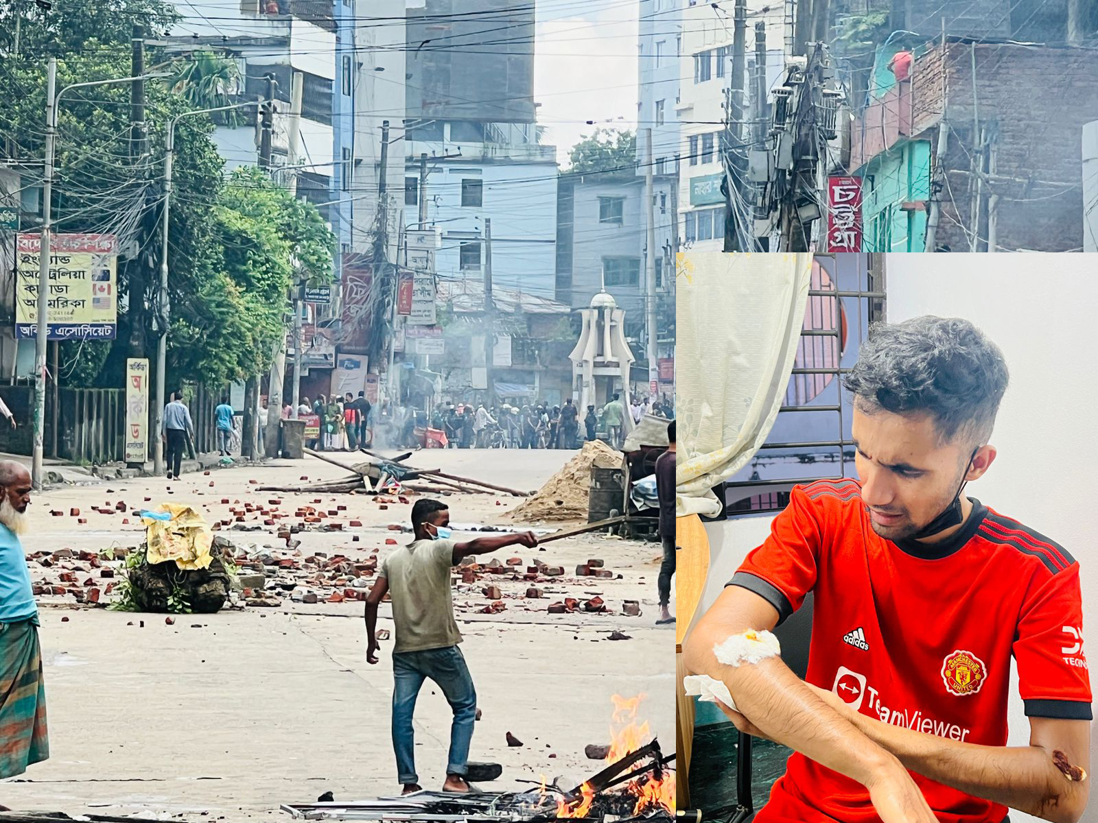 বৈষম্যবিরোধী ছাত্র আন্দোলনে পুলিশের গুলিতে আহত রাসেল আশংকামুক্ত