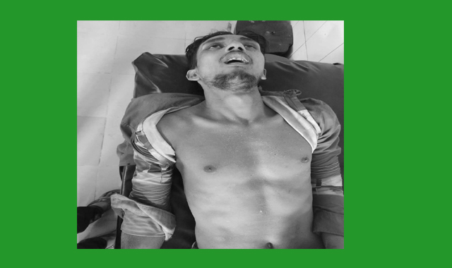 সিএনজি অটোরিকশা চুরির সময় গণপিটুনি, নিহত ১ জন